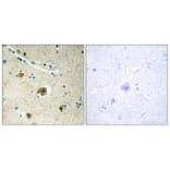 Immunohistochemistry - Anti-Collagen IV alpha4 Antibody (C12198) - Antibodies.com