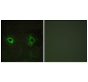 Immunofluorescence - Anti-Collagen IV alpha3 Antibody (C12197) - Antibodies.com
