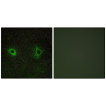 Immunofluorescence - Anti-Collagen IV alpha3 Antibody (C12197) - Antibodies.com