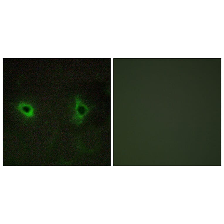Immunofluorescence - Anti-Collagen IV alpha3 Antibody (C12197) - Antibodies.com