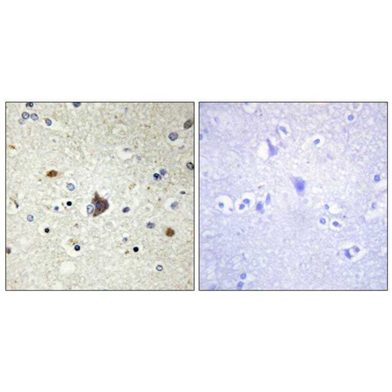 Immunohistochemistry - Anti-Collagen IV alpha3 Antibody (C12197) - Antibodies.com