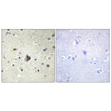 Immunohistochemistry - Anti-Collagen IV alpha3 Antibody (C12197) - Antibodies.com