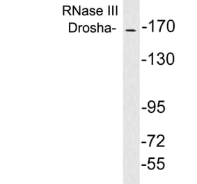 Western Blot - Anti-RNase III Drosha Antibody (R12-2334) - Antibodies.com