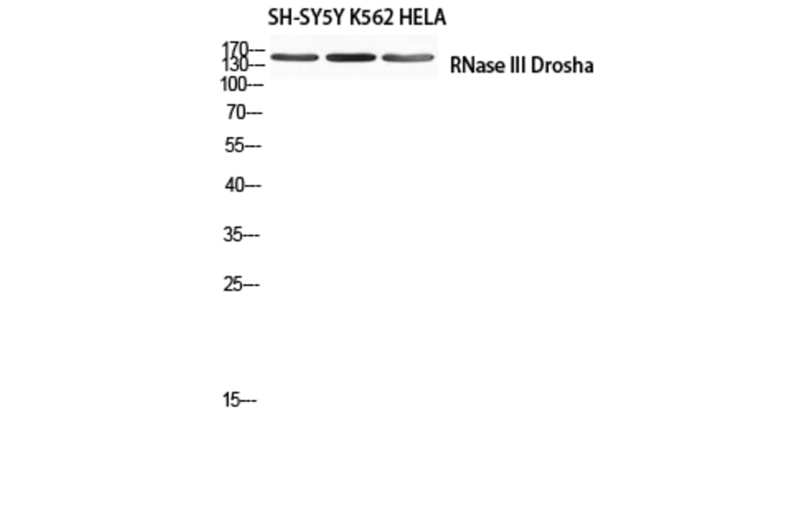 Western Blot - Anti-RNase III Drosha Antibody (R12-2334) - Antibodies.com
