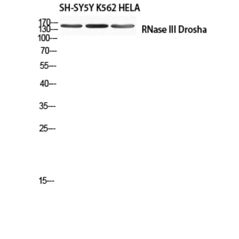 Western Blot - Anti-RNase III Drosha Antibody (R12-2334) - Antibodies.com