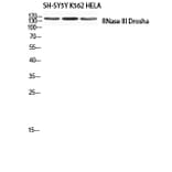 Western Blot - Anti-RNase III Drosha Antibody (R12-2334) - Antibodies.com