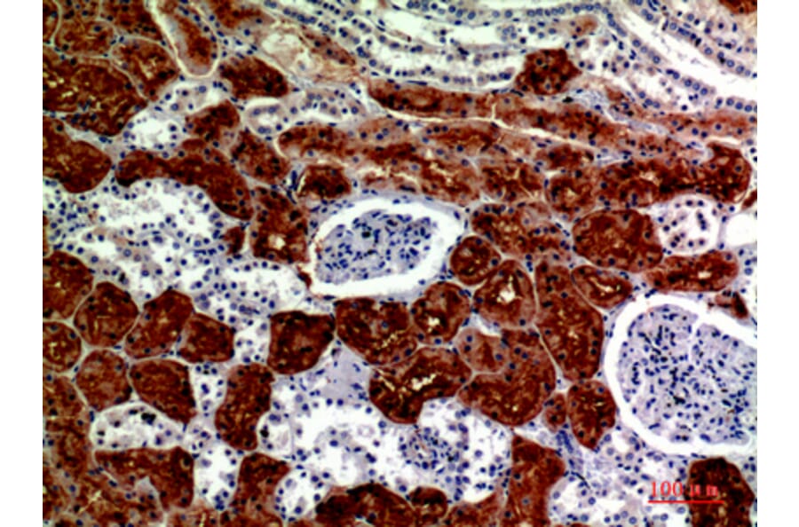 Immunohistochemistry - Anti-RNase III Drosha Antibody (R12-2334) - Antibodies.com