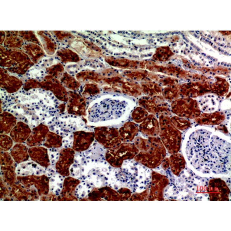 Immunohistochemistry - Anti-RNase III Drosha Antibody (R12-2334) - Antibodies.com