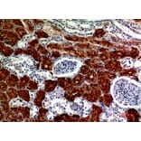 Immunohistochemistry - Anti-RNase III Drosha Antibody (R12-2334) - Antibodies.com