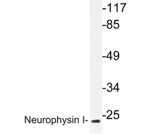 Western Blot - Anti-Neurophysin I Antibody (R12-2257) - Antibodies.com