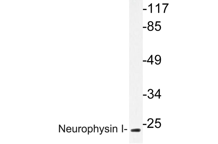 Western Blot - Anti-Neurophysin I Antibody (R12-2257) - Antibodies.com