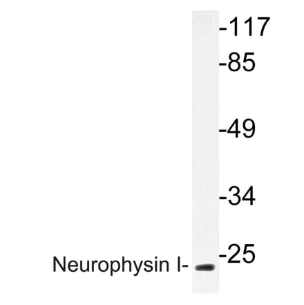 Western Blot - Anti-Neurophysin I Antibody (R12-2257) - Antibodies.com