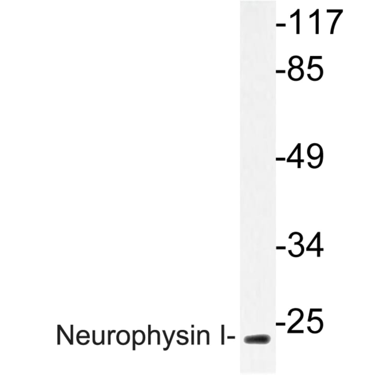 Western Blot - Anti-Neurophysin I Antibody (R12-2257) - Antibodies.com