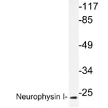 Western Blot - Anti-Neurophysin I Antibody (R12-2257) - Antibodies.com