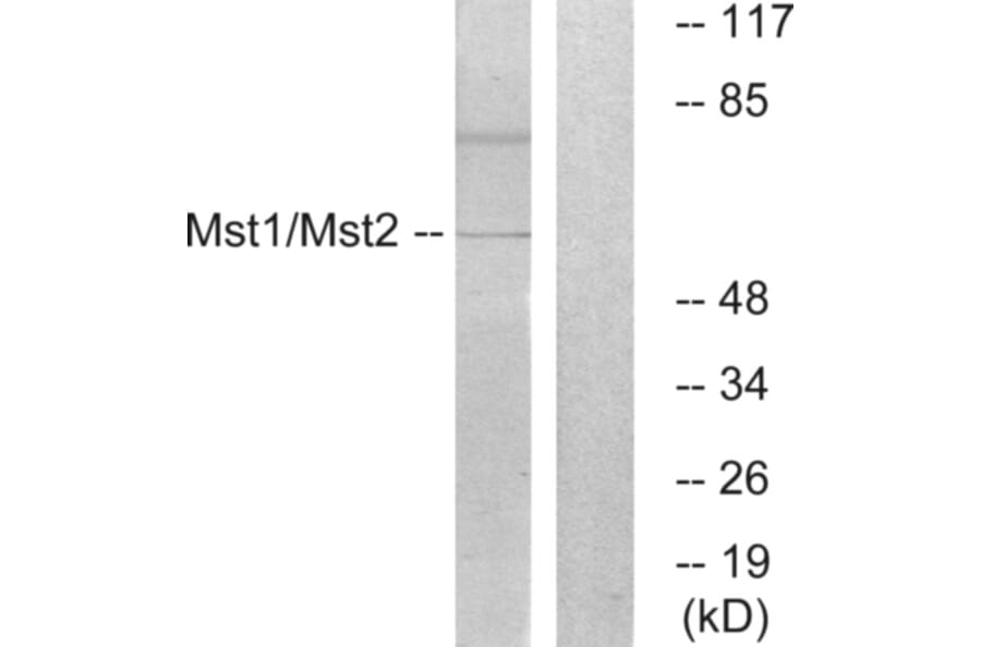 Western Blot - Anti-Mst1 + Mst2 Antibody (B0687) - Antibodies.com