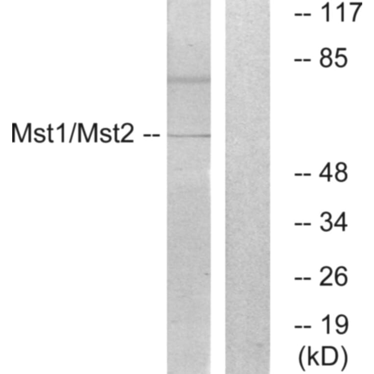 Western Blot - Anti-Mst1 + Mst2 Antibody (B0687) - Antibodies.com
