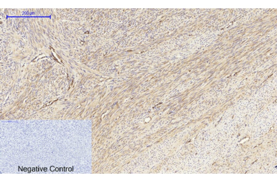 Immunohistochemistry - Anti-MEK1 + MEK2 Antibody (B7146) - Antibodies.com