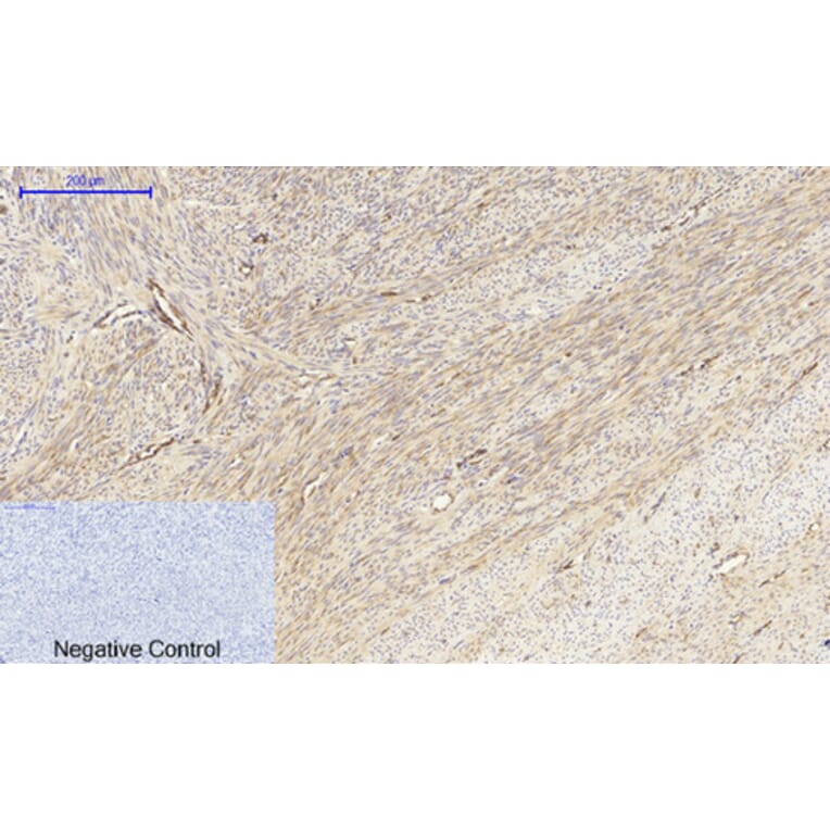Immunohistochemistry - Anti-MEK1 + MEK2 Antibody (B7146) - Antibodies.com