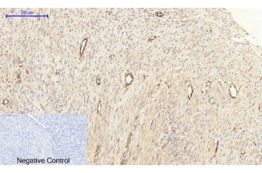 Immunohistochemistry - Anti-MEK1 + MEK2 Antibody (B7146) - Antibodies.com