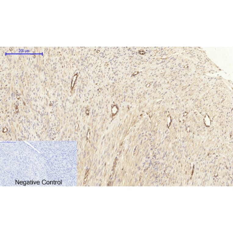 Immunohistochemistry - Anti-MEK1 + MEK2 Antibody (B7146) - Antibodies.com