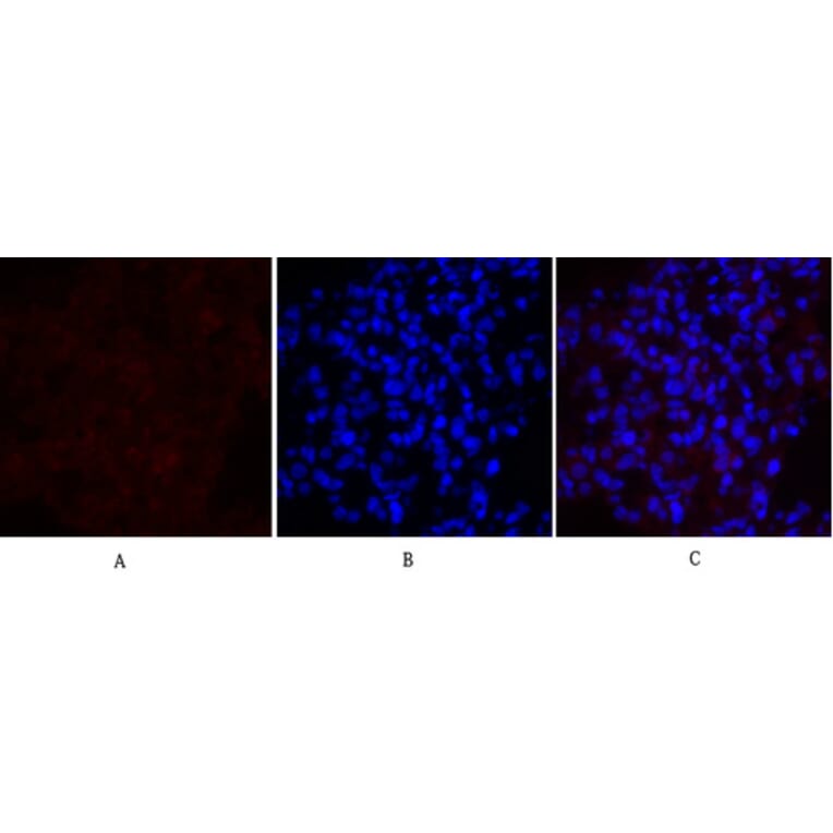 Immunofluorescence - Anti-MEK1 + MEK2 Antibody (B7146) - Antibodies.com