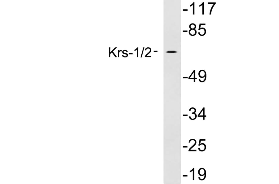 Western Blot - Anti-Krs1 + Krs2 Antibody (R12-2223) - Antibodies.com