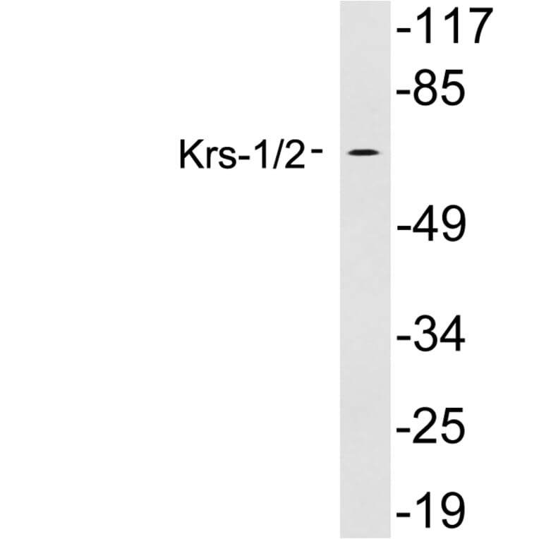 Western Blot - Anti-Krs1 + Krs2 Antibody (R12-2223) - Antibodies.com