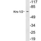 Western Blot - Anti-Krs1 + Krs2 Antibody (R12-2223) - Antibodies.com