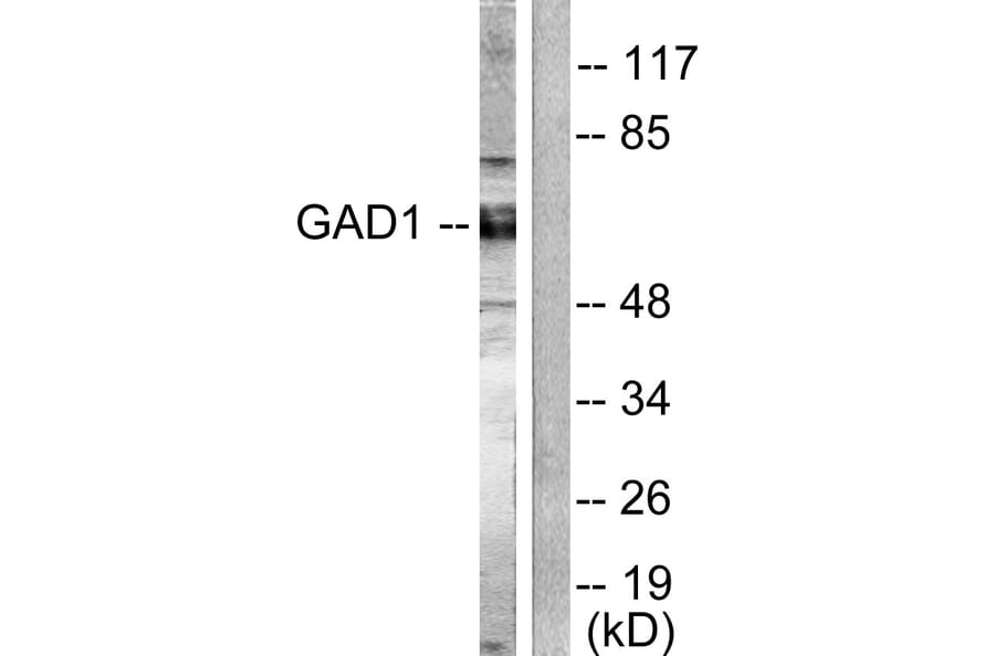 Western Blot - Anti-GAD1 + GAD2 Antibody (C0201) - Antibodies.com