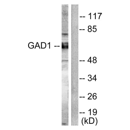 Western Blot - Anti-GAD1 + GAD2 Antibody (C0201) - Antibodies.com