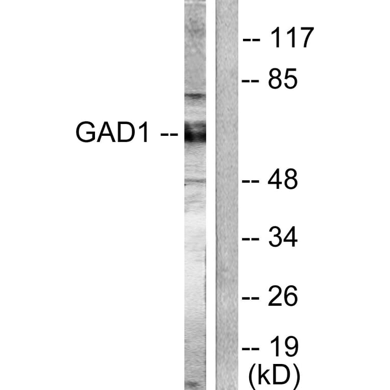 Western Blot - Anti-GAD1 + GAD2 Antibody (C0201) - Antibodies.com