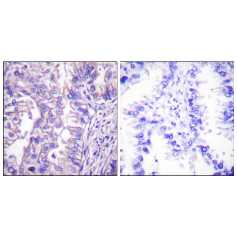 Immunohistochemistry - Anti-GAD1 + GAD2 Antibody (C0201) - Antibodies.com