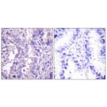 Immunohistochemistry - Anti-GAD1 + GAD2 Antibody (C0201) - Antibodies.com