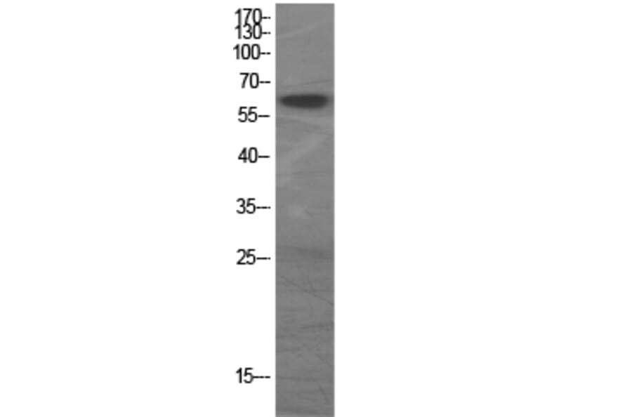 Western Blot - Anti-GAD1 + GAD2 Antibody (C0201) - Antibodies.com