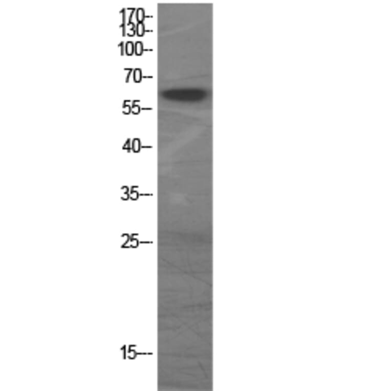 Western Blot - Anti-GAD1 + GAD2 Antibody (C0201) - Antibodies.com
