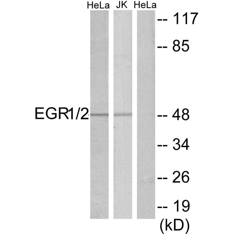 Western Blot - Anti-EGR1 + EGR2 Antibody (C10416) - Antibodies.com
