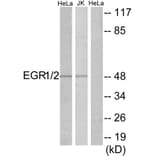 Western Blot - Anti-EGR1 + EGR2 Antibody (C10416) - Antibodies.com