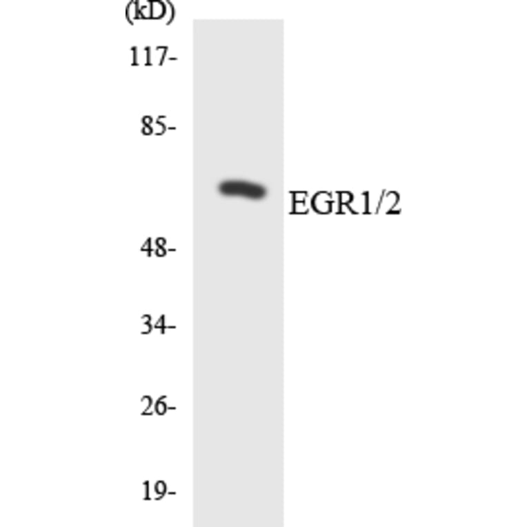 Western Blot - Anti-EGR1 + EGR2 Antibody (R12-2736) - Antibodies.com