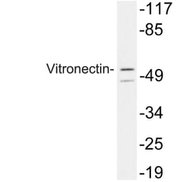 Western Blot - Anti-Vitronectin Antibody (R12-2413) - Antibodies.com