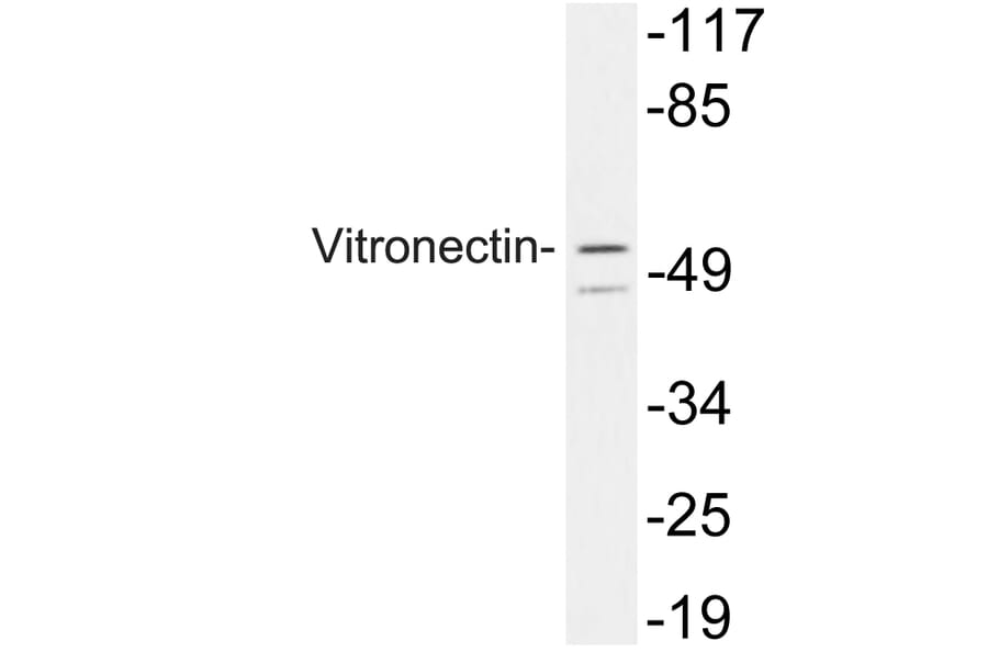 Western Blot - Anti-Vitronectin Antibody (R12-2413) - Antibodies.com