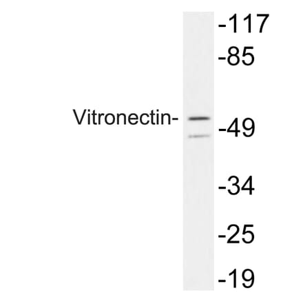 Western Blot - Anti-Vitronectin Antibody (R12-2413) - Antibodies.com
