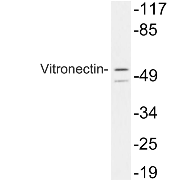 Western Blot - Anti-Vitronectin Antibody (R12-2413) - Antibodies.com