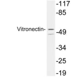 Western Blot - Anti-Vitronectin Antibody (R12-2413) - Antibodies.com