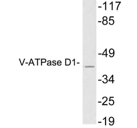 Western Blot - Anti-V-ATPase D1 Antibody (R12-2406) - Antibodies.com