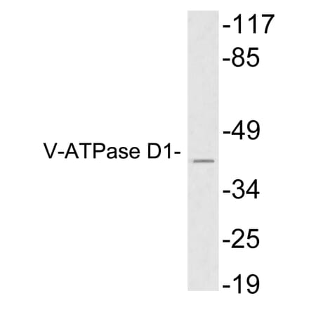 Western Blot - Anti-V-ATPase D1 Antibody (R12-2406) - Antibodies.com