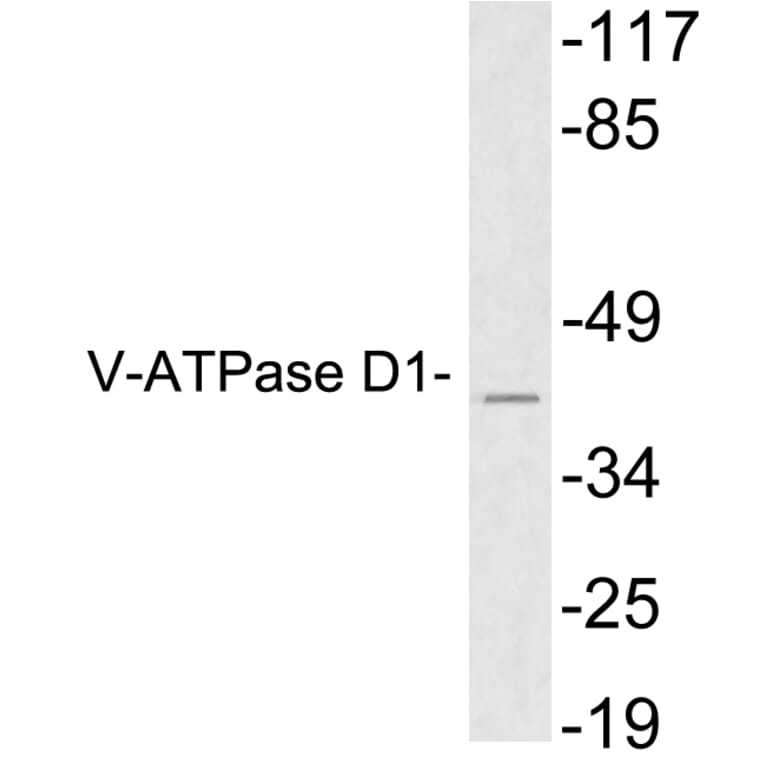 Western Blot - Anti-V-ATPase D1 Antibody (R12-2406) - Antibodies.com