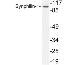 Western Blot - Anti-Synphilin-1 Antibody (R12-2371) - Antibodies.com