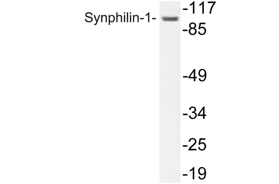 Western Blot - Anti-Synphilin-1 Antibody (R12-2371) - Antibodies.com