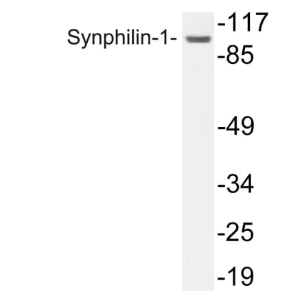 Western Blot - Anti-Synphilin-1 Antibody (R12-2371) - Antibodies.com