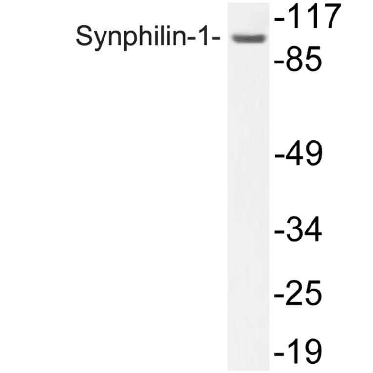 Western Blot - Anti-Synphilin-1 Antibody (R12-2371) - Antibodies.com